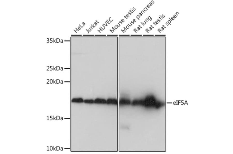 Western Blot - Anti-eIF5A Antibody [ARC0999] (A306839) - Antibodies.com