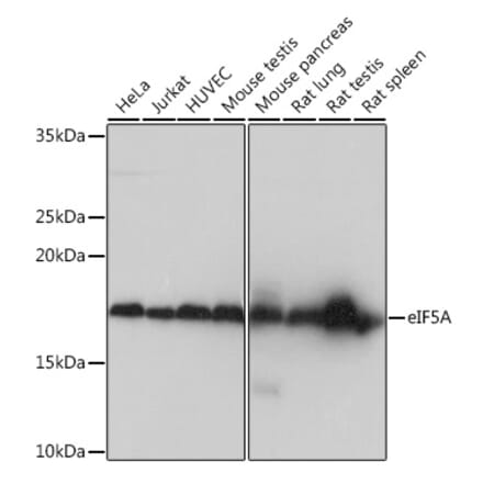Western Blot - Anti-eIF5A Antibody [ARC0999] (A306839) - Antibodies.com