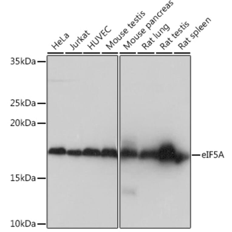 Western Blot - Anti-eIF5A Antibody [ARC0999] (A306839) - Antibodies.com