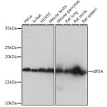 Western Blot - Anti-eIF5A Antibody [ARC0999] (A306839) - Antibodies.com