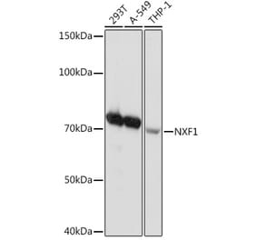 Western Blot - Anti-NXF1 Antibody [ARC2013] (A306841) - Antibodies.com
