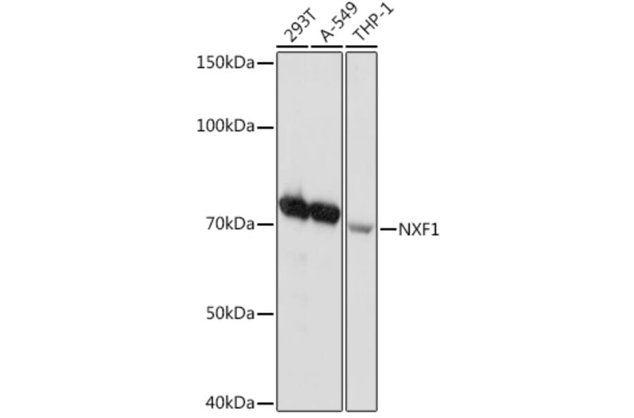 Western Blot - Anti-NXF1 Antibody [ARC2013] (A306841) - Antibodies.com