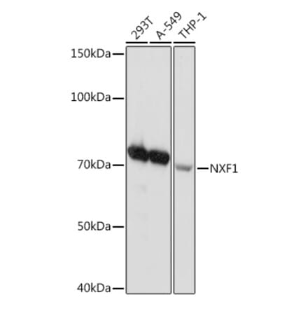 Western Blot - Anti-NXF1 Antibody [ARC2013] (A306841) - Antibodies.com