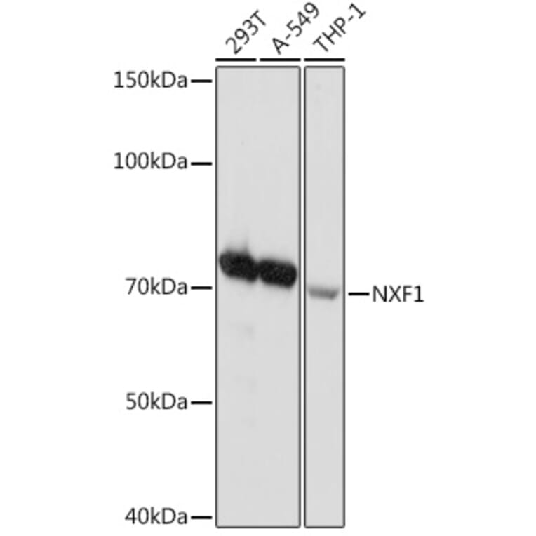 Western Blot - Anti-NXF1 Antibody [ARC2013] (A306841) - Antibodies.com