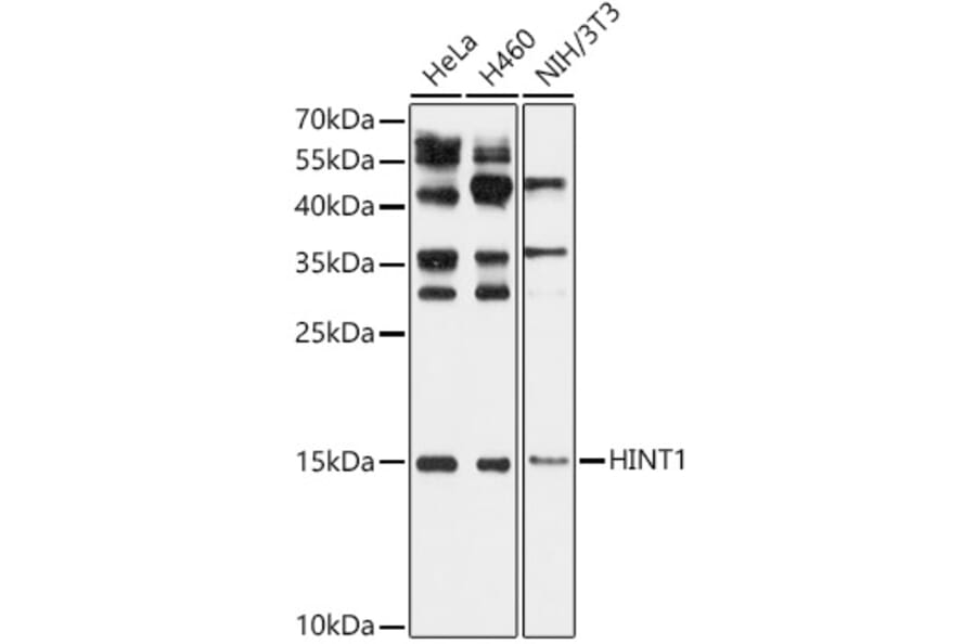 Western Blot - Anti-HINT1 Antibody (A306843) - Antibodies.com