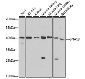 Western Blot - Anti-GNA13 Antibody (A306847) - Antibodies.com