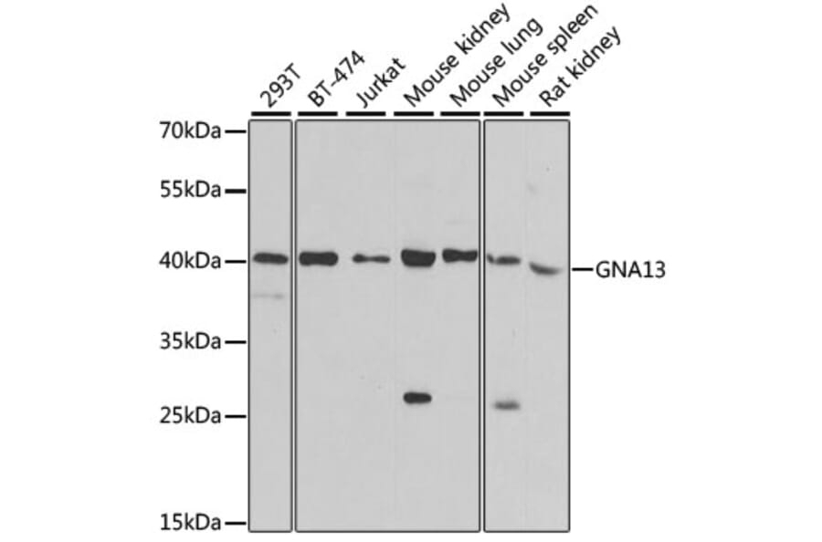 Western Blot - Anti-GNA13 Antibody (A306847) - Antibodies.com
