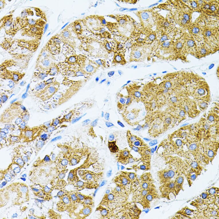 Immunohistochemistry - Anti-GNA13 Antibody (A306847) - Antibodies.com
