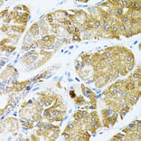 Immunohistochemistry - Anti-GNA13 Antibody (A306847) - Antibodies.com