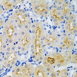 Immunohistochemistry - Anti-GNA13 Antibody (A306847) - Antibodies.com