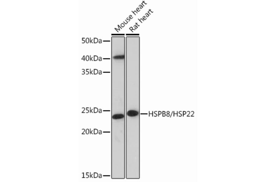Western Blot - Anti-Hsp22/HSPB8 Antibody [ARC0715] (A306849) - Antibodies.com