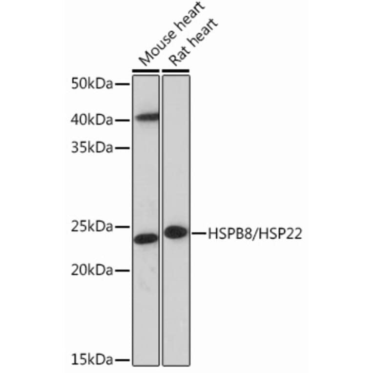 Western Blot - Anti-Hsp22/HSPB8 Antibody [ARC0715] (A306849) - Antibodies.com