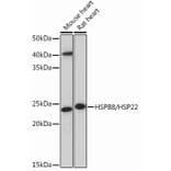 Western Blot - Anti-Hsp22/HSPB8 Antibody [ARC0715] (A306849) - Antibodies.com