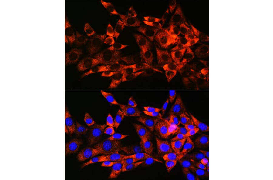 Immunofluorescence - Anti-Hsp22/HSPB8 Antibody [ARC0715] (A306849) - Antibodies.com