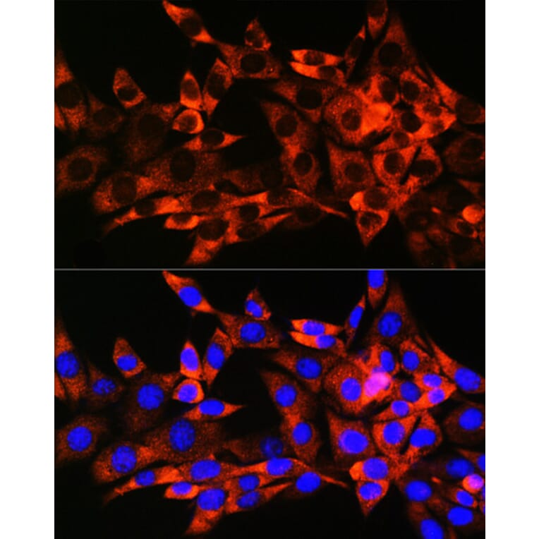 Immunofluorescence - Anti-Hsp22/HSPB8 Antibody [ARC0715] (A306849) - Antibodies.com