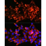 Immunofluorescence - Anti-Hsp22/HSPB8 Antibody [ARC0715] (A306849) - Antibodies.com