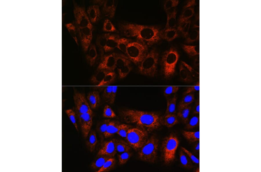 Immunofluorescence - Anti-Hsp22/HSPB8 Antibody [ARC0715] (A306849) - Antibodies.com