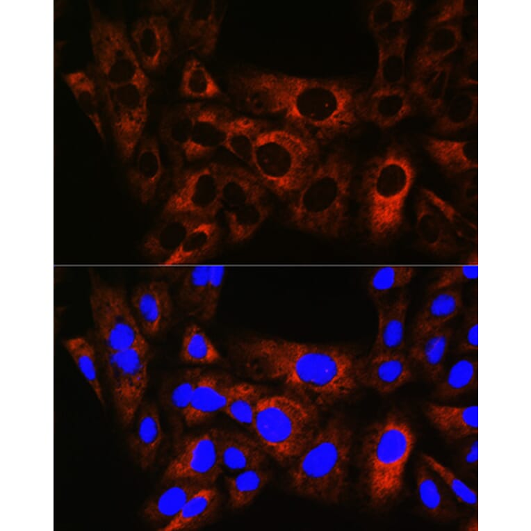 Immunofluorescence - Anti-Hsp22/HSPB8 Antibody [ARC0715] (A306849) - Antibodies.com