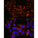 Immunofluorescence - Anti-Hsp22/HSPB8 Antibody [ARC0715] (A306849) - Antibodies.com