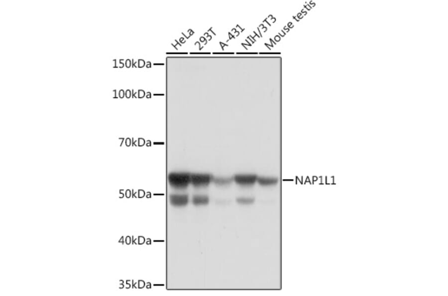 Western Blot - Anti-NAP1L1 Antibody [ARC1888] (A306850) - Antibodies.com