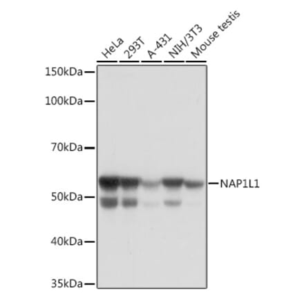 Western Blot - Anti-NAP1L1 Antibody [ARC1888] (A306850) - Antibodies.com