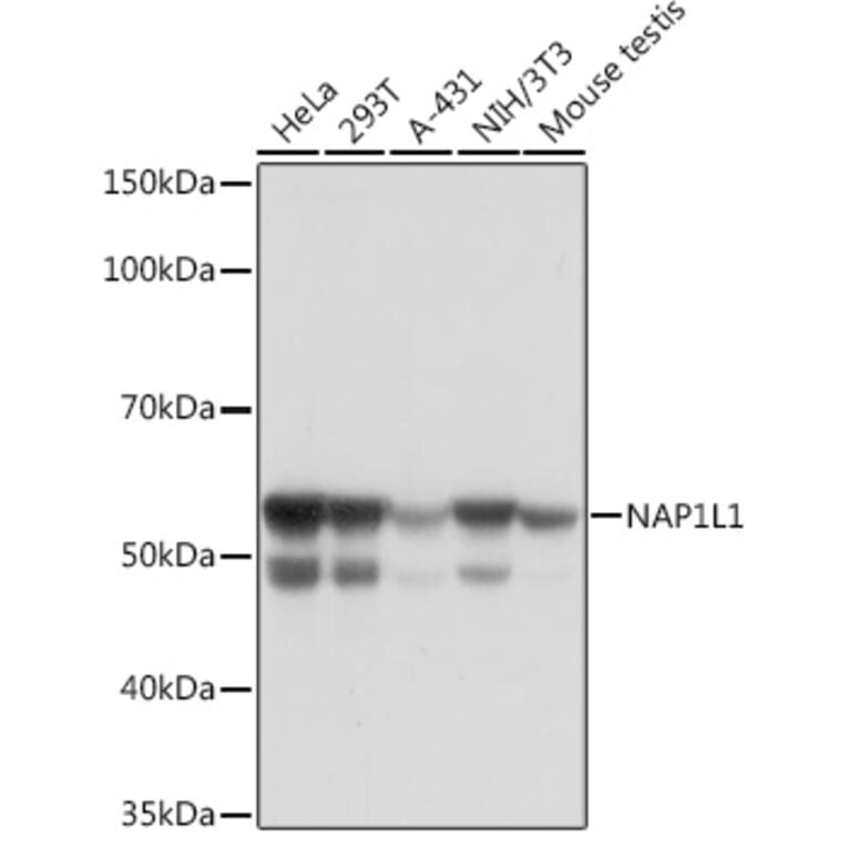 Western Blot - Anti-NAP1L1 Antibody [ARC1888] (A306850) - Antibodies.com