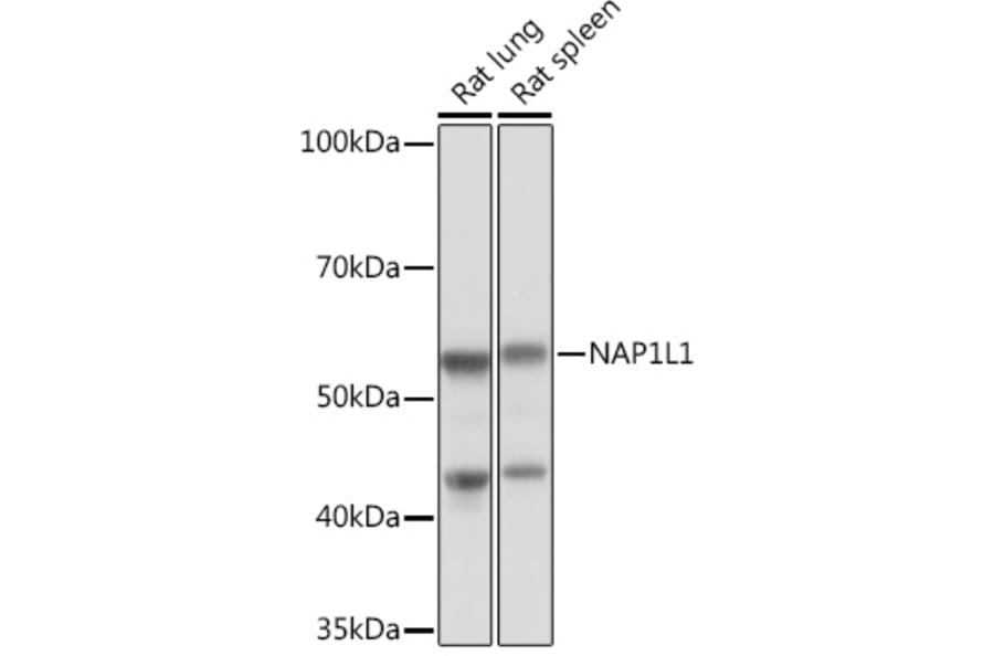 Western Blot - Anti-NAP1L1 Antibody [ARC1888] (A306850) - Antibodies.com