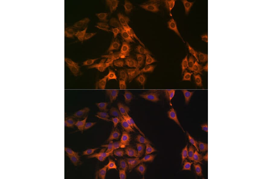 Immunofluorescence - Anti-NAP1L1 Antibody [ARC1888] (A306850) - Antibodies.com