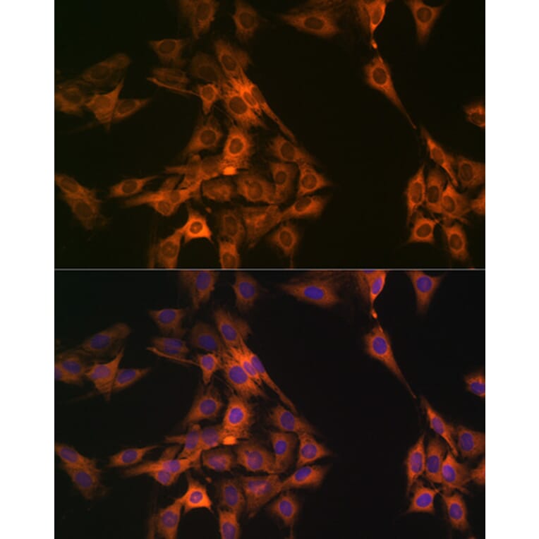 Immunofluorescence - Anti-NAP1L1 Antibody [ARC1888] (A306850) - Antibodies.com