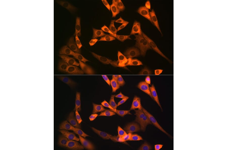 Immunofluorescence - Anti-NAP1L1 Antibody [ARC1888] (A306850) - Antibodies.com