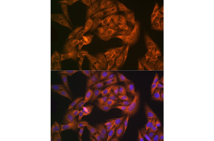 Immunofluorescence - Anti-NAP1L1 Antibody [ARC1888] (A306850) - Antibodies.com