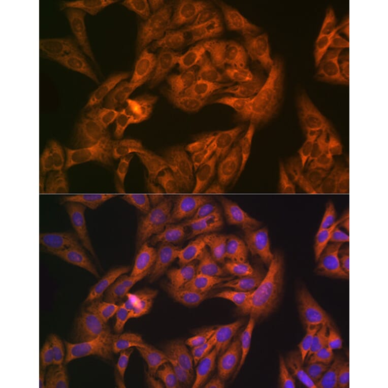 Immunofluorescence - Anti-NAP1L1 Antibody [ARC1888] (A306850) - Antibodies.com