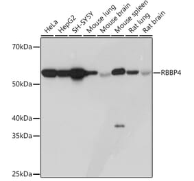 Western Blot - Anti-RBBP4 Antibody [ARC0813] (A306852) - Antibodies.com