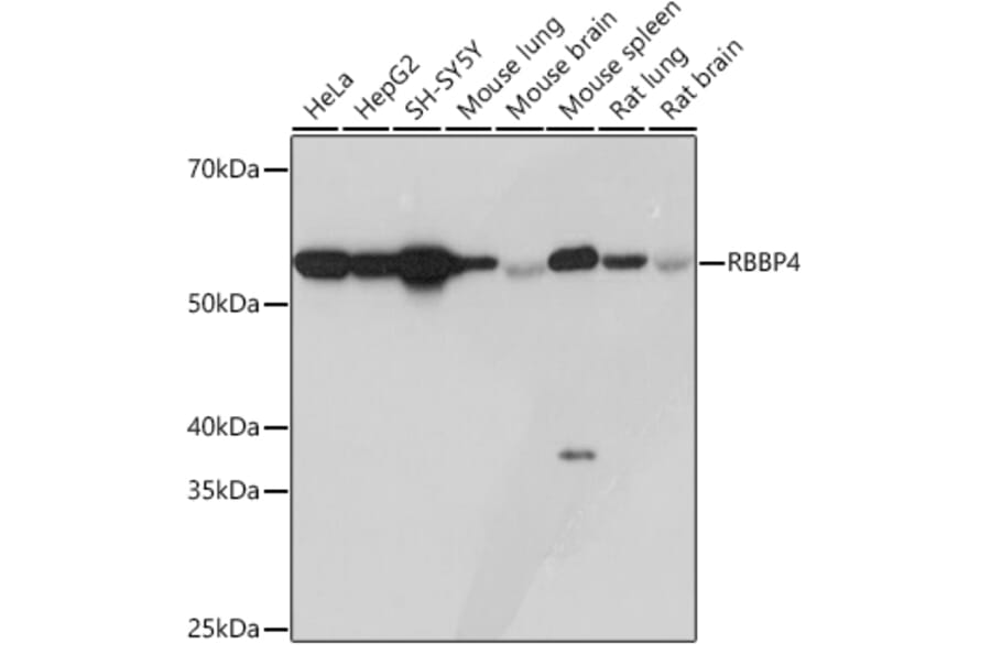 Western Blot - Anti-RBBP4 Antibody [ARC0813] (A306852) - Antibodies.com