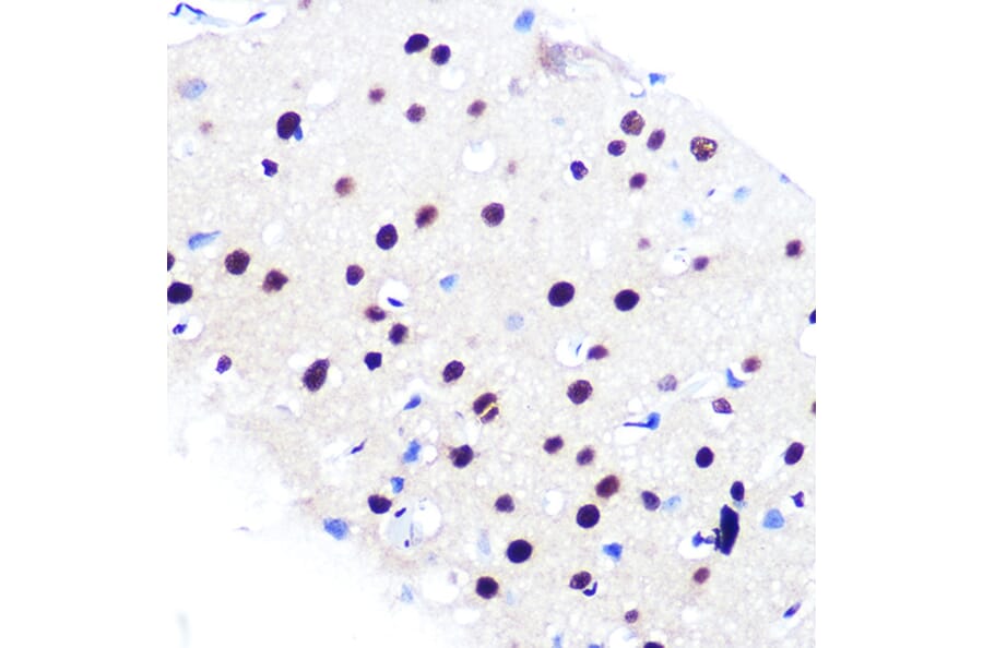 Immunohistochemistry - Anti-RBBP4 Antibody [ARC0813] (A306852) - Antibodies.com