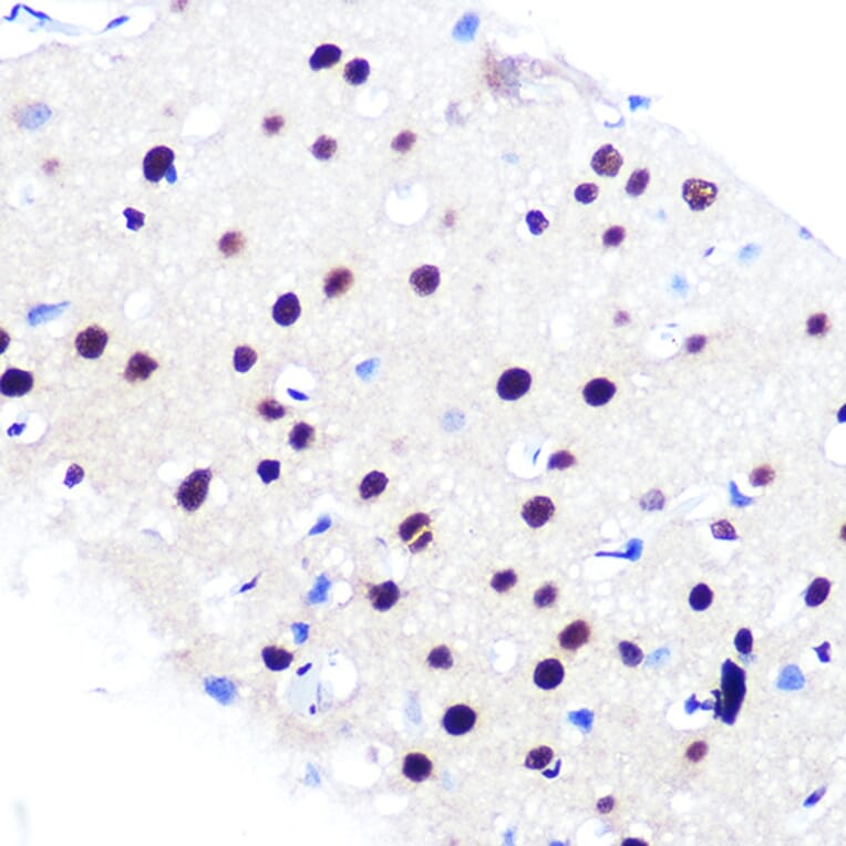 Immunohistochemistry - Anti-RBBP4 Antibody [ARC0813] (A306852) - Antibodies.com