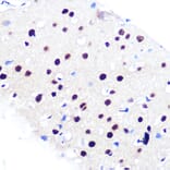 Immunohistochemistry - Anti-RBBP4 Antibody [ARC0813] (A306852) - Antibodies.com
