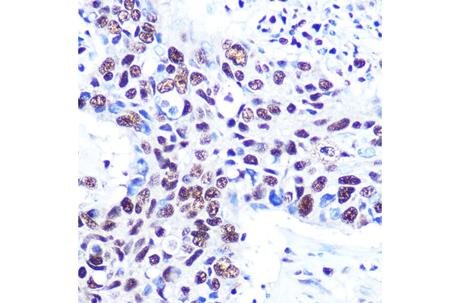 Immunohistochemistry - Anti-RBBP4 Antibody [ARC0813] (A306852) - Antibodies.com