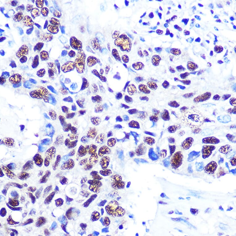 Immunohistochemistry - Anti-RBBP4 Antibody [ARC0813] (A306852) - Antibodies.com