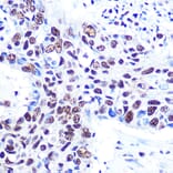 Immunohistochemistry - Anti-RBBP4 Antibody [ARC0813] (A306852) - Antibodies.com