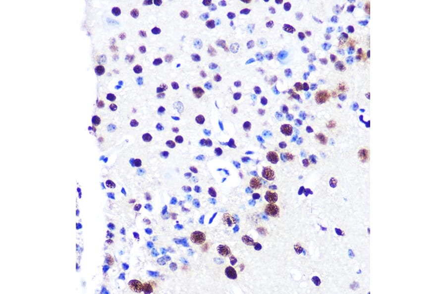 Immunohistochemistry - Anti-RBBP4 Antibody [ARC0813] (A306852) - Antibodies.com