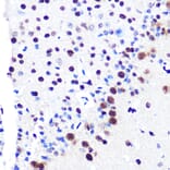 Immunohistochemistry - Anti-RBBP4 Antibody [ARC0813] (A306852) - Antibodies.com