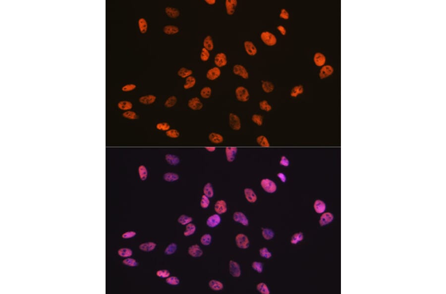 Immunofluorescence - Anti-RBBP4 Antibody [ARC0813] (A306852) - Antibodies.com
