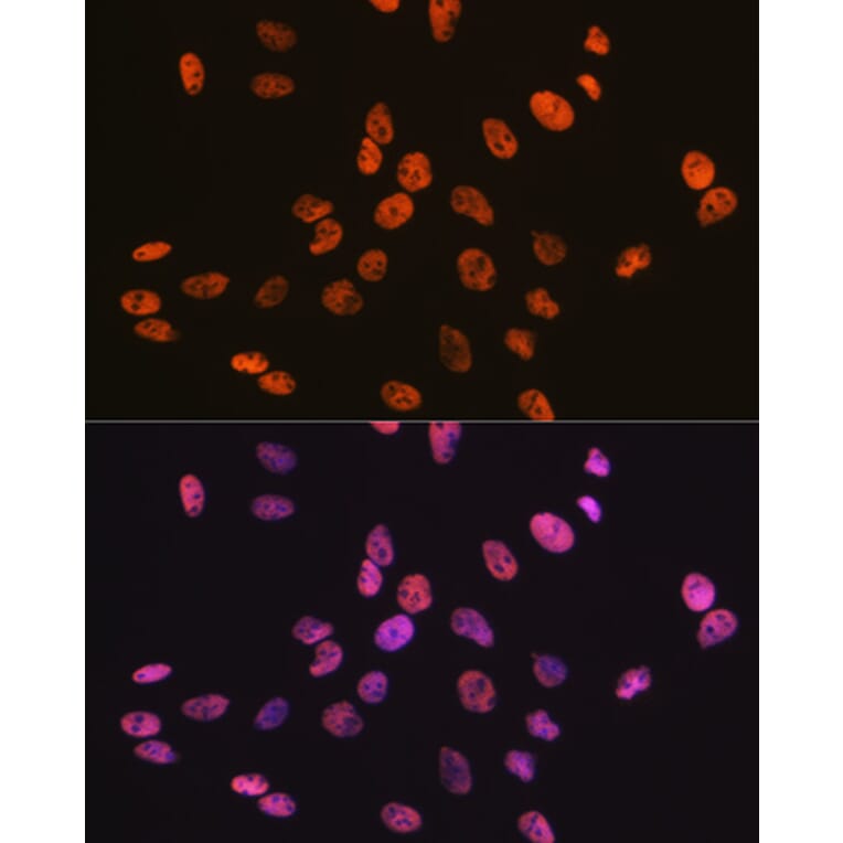 Immunofluorescence - Anti-RBBP4 Antibody [ARC0813] (A306852) - Antibodies.com