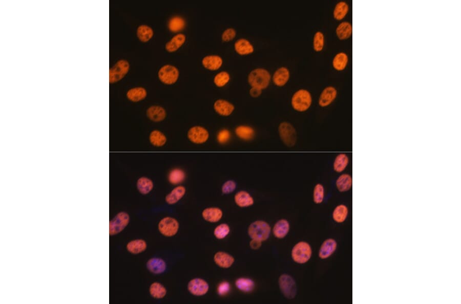 Immunofluorescence - Anti-RBBP4 Antibody [ARC0813] (A306852) - Antibodies.com