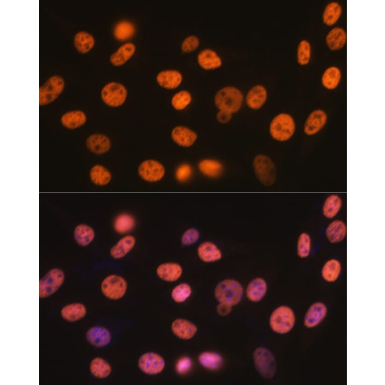 Immunofluorescence - Anti-RBBP4 Antibody [ARC0813] (A306852) - Antibodies.com