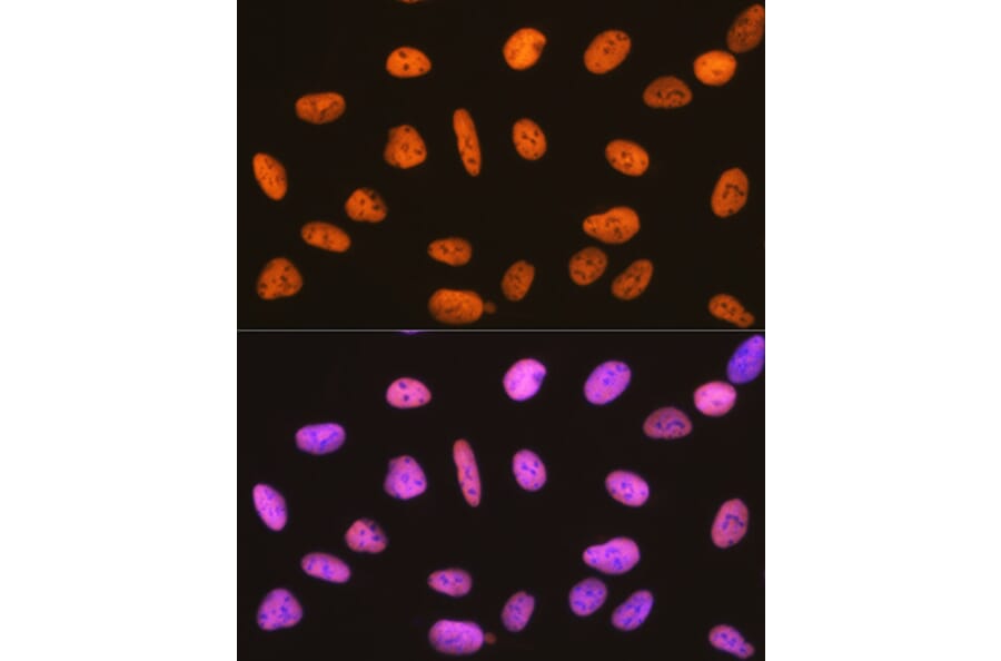 Immunofluorescence - Anti-RBBP4 Antibody [ARC0813] (A306852) - Antibodies.com