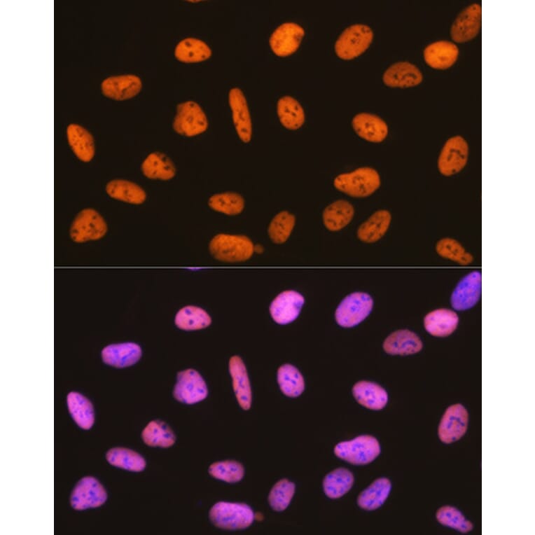 Immunofluorescence - Anti-RBBP4 Antibody [ARC0813] (A306852) - Antibodies.com