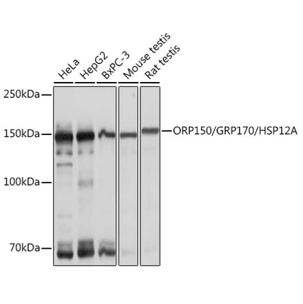 Western Blot - Anti-ORP150 Antibody [ARC1857] (A306853) - Antibodies.com