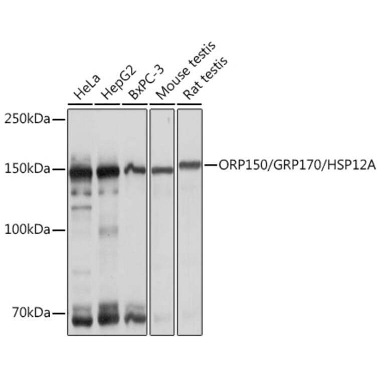 Western Blot - Anti-ORP150 Antibody [ARC1857] (A306853) - Antibodies.com